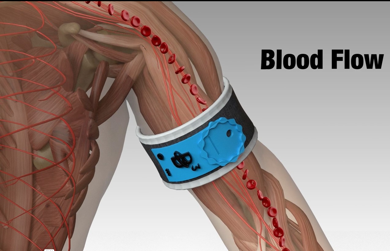 B3 Bands for Blood Clots - B3 Sciences